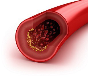 Cholesterol And Erectile Dysfunction